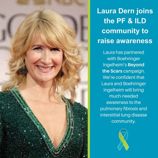 Diane Ladd Obituary: Beloved Mother of Laura Dern and Legendary Actress Passes Away