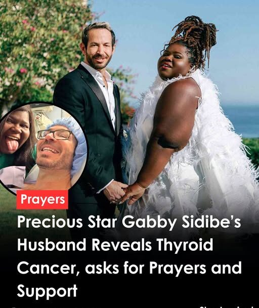 Strength in Unity: Gabourey Sidibe Supports Husband Brandon Frankel Through Stage I Papillary Thyroid Cancer Diagnosis and Recovery