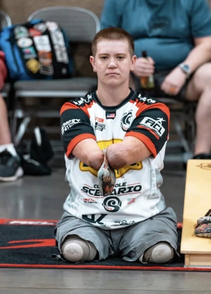 Professional Cornhole Player with Limb Differences Accused in Murder Case